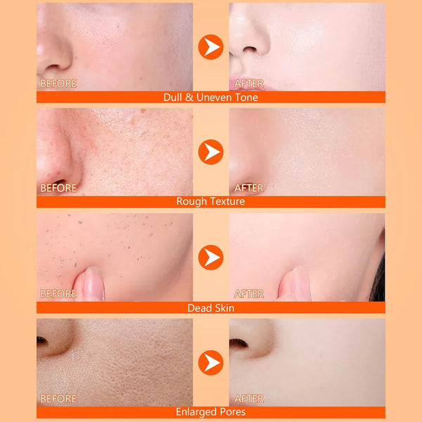 BrightSkin Kojic Turmeric Mist Revive